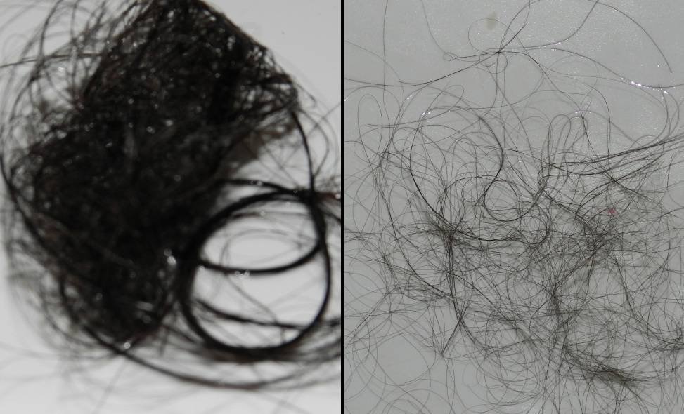 Почему выпадают волосы после мытья. Норма выпадения волос.