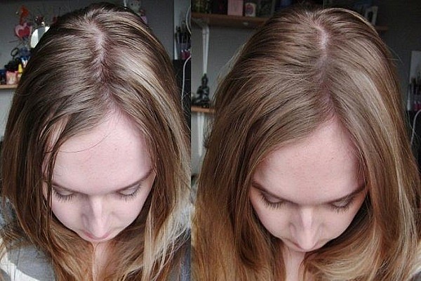 Как использовать сухой шампунь для волос - результат