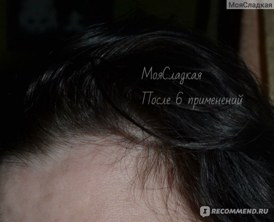 Разогревающая маска против выпадения волос Faberlic Expert Pharma фото