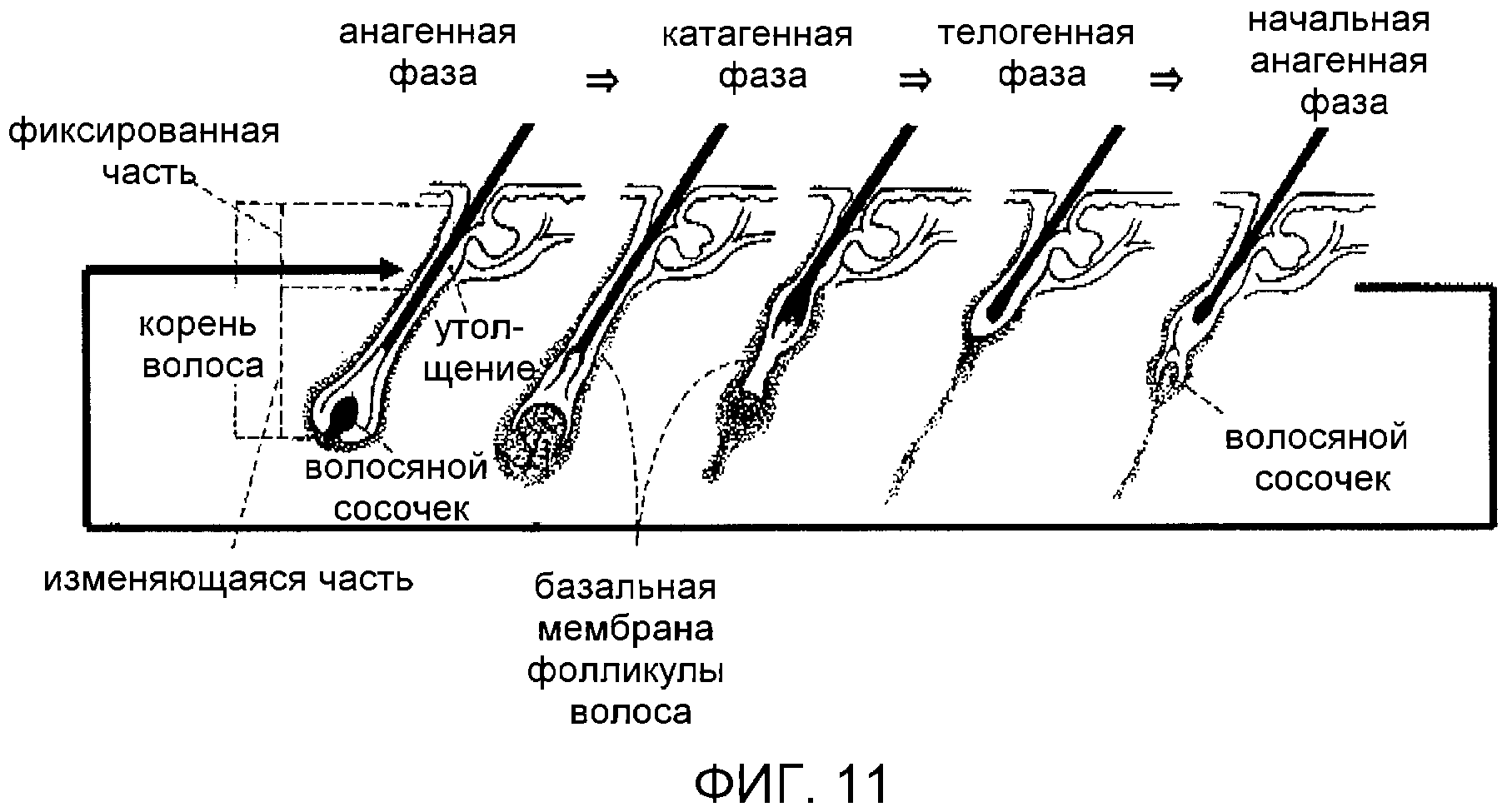 Фаза роста. Стадии роста волос. Фазы роста волос. Цикл развития волос. Фазы роста волоса человека.