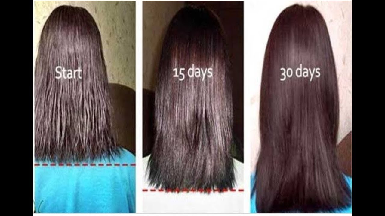 Сколько растут волосы на голове за месяц. Рост волос в месяц. Волосы до после. Как растут волосы. Волосы отрасли за год.