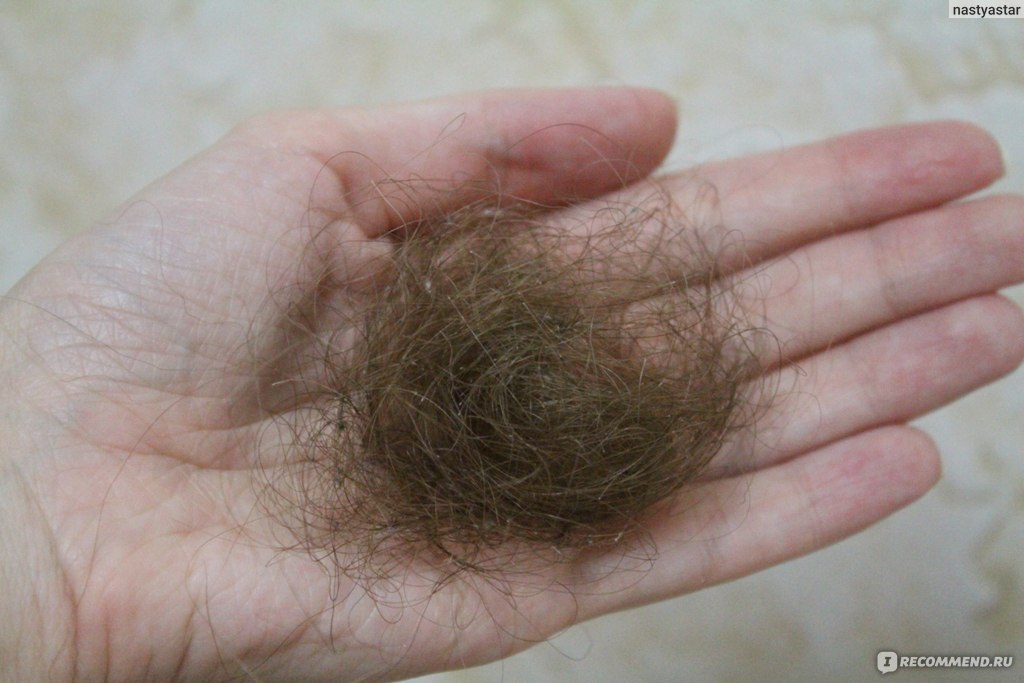 Почему выпадают волосы после мытья. Норма выпадения волос. Норма выпадения волос на голове.