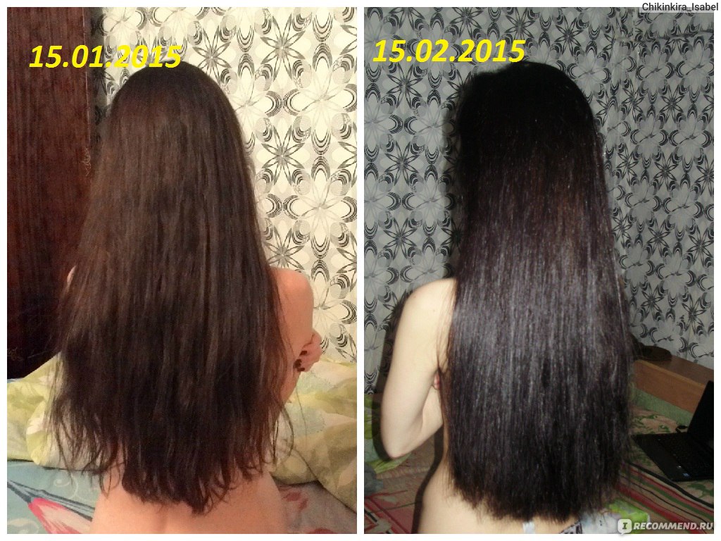 Irecommend волосы. Никотиновая кислота рост волос эффект. Отращивание волос до и после. Отрастить волосы никотиновой кислотой. Волосы за 4 месяца.