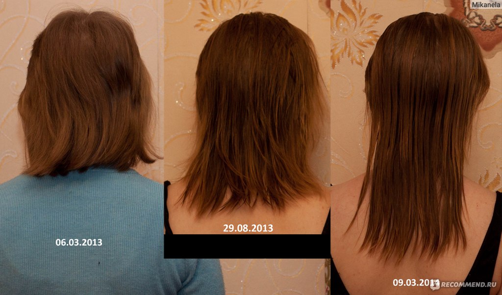 Волосы за 6 месяцев. Рост волос на голове за год. Рост волос в месяц. Рост волос в месяц за год. Рост волос по месяцам.