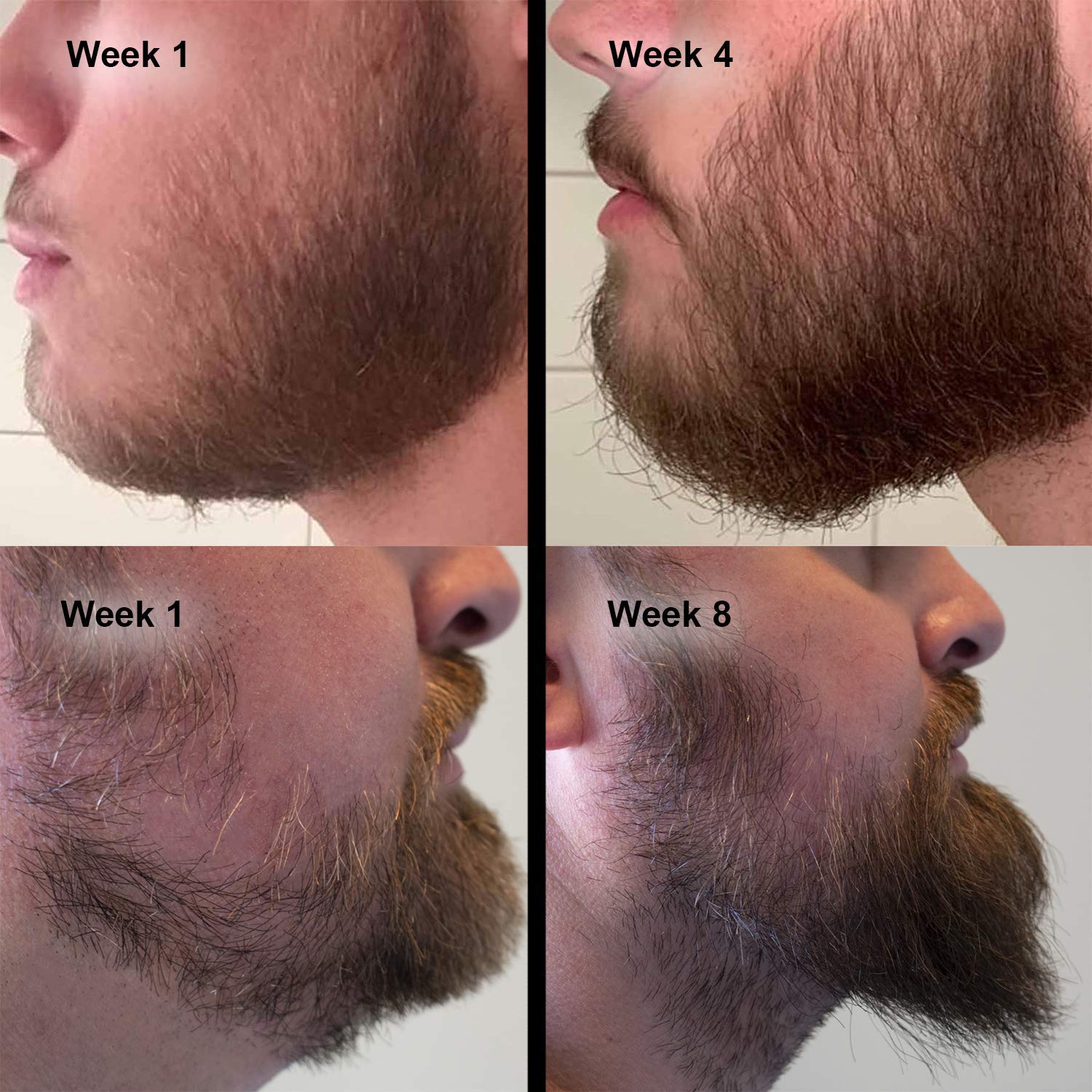 Активатор роста бороды. Heavy Beard миноксидил. Рост бороды. Миноксидил NARXLARI. Этапы роста бороды.