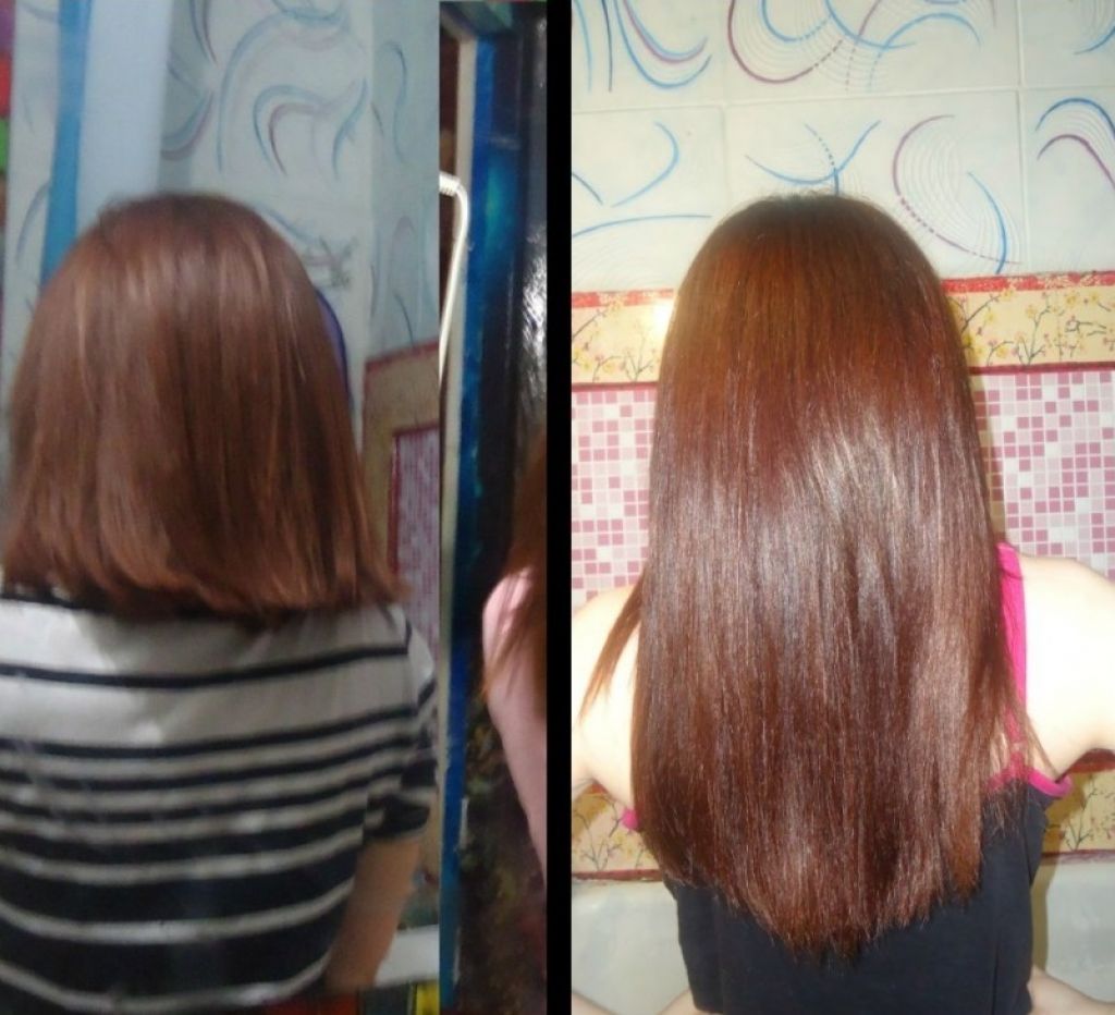 Ополаскивание крапивой. Отращивание волос до и после. Рост волос до и после. Волосы после ополаскивания крапивой. Волосы после крапивы до и после.