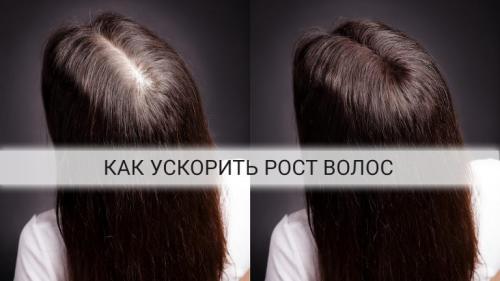 Как понять, что волосы растут. Как и от чего растут волосы на голове?