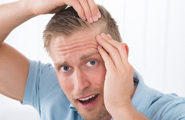 Себорея - причина выпадения волос